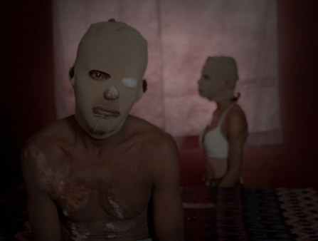 A shirtless, heavily scarred young man poses for the camera wearing a skin-colored mask while a woman in just a bra with the same mask stands behind him