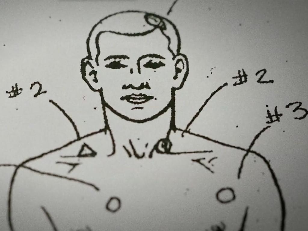 diagram of male body with markings of bullet entrance wounds