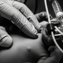 Black-and-white close-up of a gloved medical hand touching a newborn baby’s chest amid tubes and monitoring equipment in a neonatal care setting.